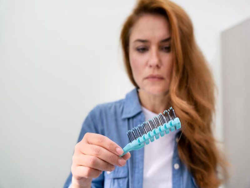 perte de cheveux responsable de la calvitie