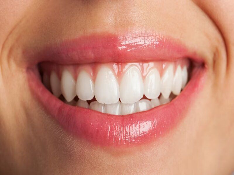 Astuces pour avoir des dents plus blanches naturellement