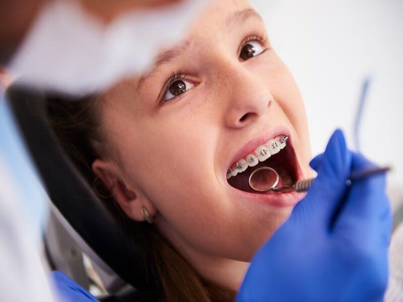 Les différents types de traitements orthodontiques
