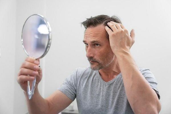 Homme recevant un traitement contre la perte de cheveux. Chute de cheveux temporaire causes et symptômes