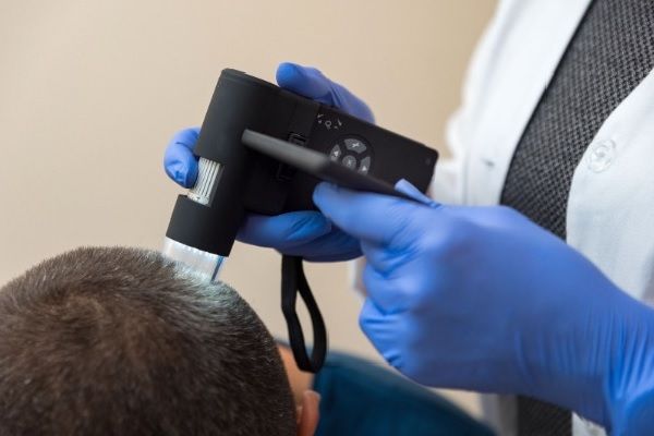 Les clés pour prendre soin des cheveux greffés