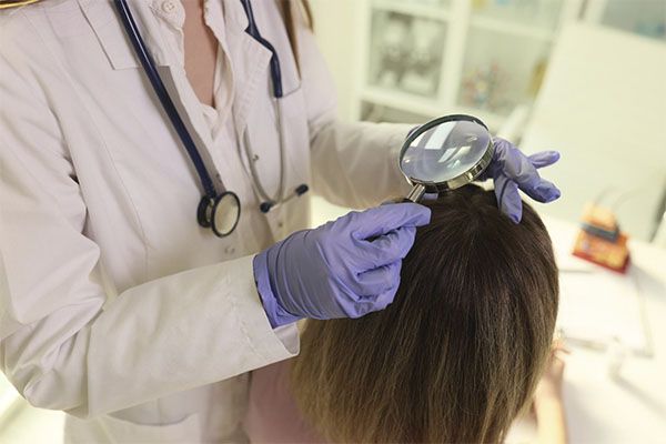 greffe de cheveux en France