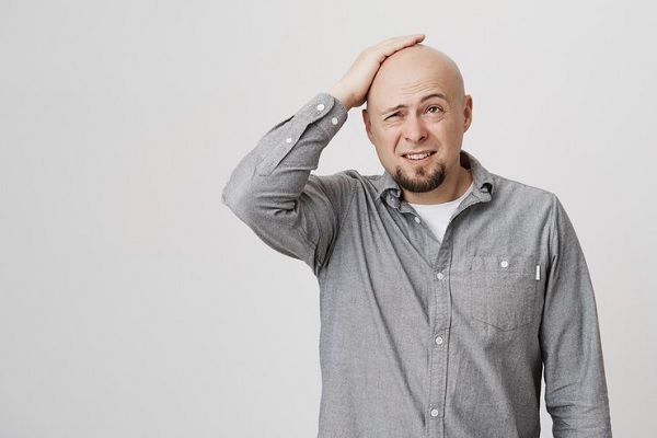Un homme chauve adulte troublé s'est cogné la tête en grimaçant. Problèmes de santé mentale quotidiens chez les hommes et comment ils affectent les cheveux 