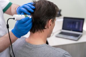 Homme recevant un traitement pour la perte de cheveux. greffe de cheveux en France