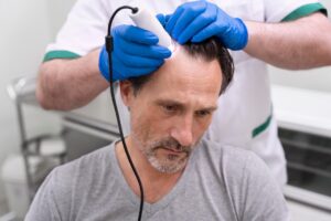 Homme recevant un traitement pour la perte de cheveux. 