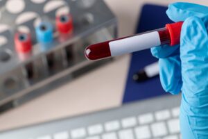 Chirurgien effectuant une prise de sang. l'hémophilie