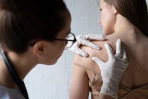 Femme médecin diagnostiquant un mélanome sur le corps d'une patiente