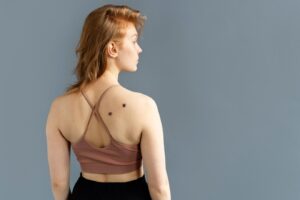 Plan moyen d'une jeune femme avec des grains de beauté