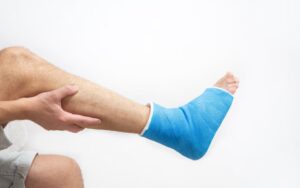 Attelle de cheville bleue. Plâtre de jambe bandé sur un patient masculin sur fond blanc isolé. Indications pour la greffe de moelle osseuse