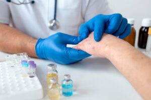 Allergie cutanée sur le bras d'une personne.
