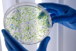 Laborantin examinant une substance verte sur une boîte de Petri tout en conduisant. Staphylococcus aureus. Staphylococcus aureus