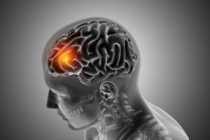 Figure médicale masculine avec l'avant du cerveau mis en évidence. maladies neuromusculaires