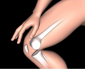 
Figure médicale masculine en 3D avec os de la jambe mis en évidence. Qu'est-ce que la densité osseuse