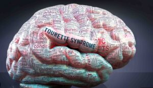 Qu’est-ce que le syndrome de Tourette. 
