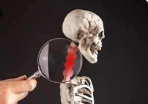 Les symptômes et le diagnostic de l'ostéogenèse imparfaite