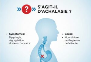 Comprendre la difficulte a avaler sagit il d achalasie