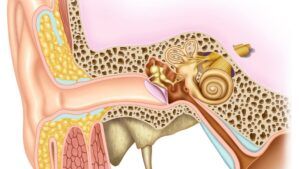 L'imagerie médicale (Scanner et IRM)