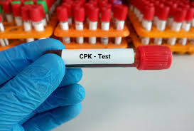Comprendre la creatine phosphokinase cpk que signifie un taux eleve dans le sang