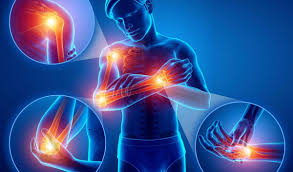 Comprendre l'osteogenese imparfaite tout savoir sur la maladie des os de verre