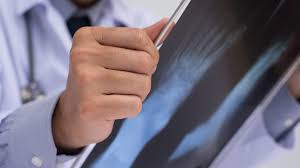 Diagnostic, traitements et complications rares