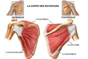 Comprendre la lesion de la coiffe des rotateurs et ses mécanismes
