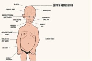 Informations techniques essentielles sur la maladie