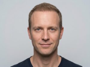 Évolution de la densité capillaire six mois après une greffe de cheveux