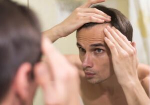 Pourquoi la greffe de cheveux devient-elle la solution la plus demandée contre la calvitie