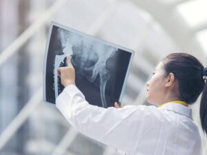 Quelle est la cause exacte de la fibrodysplasie ossifiante progressive