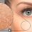 Xeroderma pigmentosum : symptômes, causes et prise en charge