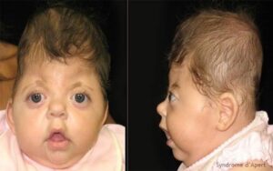 Informations techniques essentielles sur le diagnostic et la prise en charge