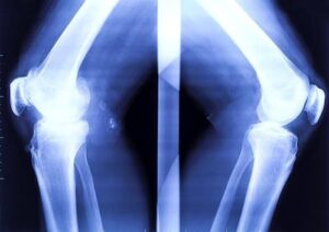 Quels sont les premiers signes de la maladie chez un enfant
