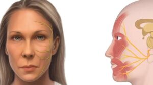 Comment gérer les problèmes de sécheresse oculaire au quotidien