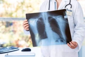 Comment les médecins diagnostiquent-ils cette maladie rare