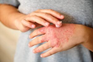 Diagnostic médical et caractéristiques biologiques